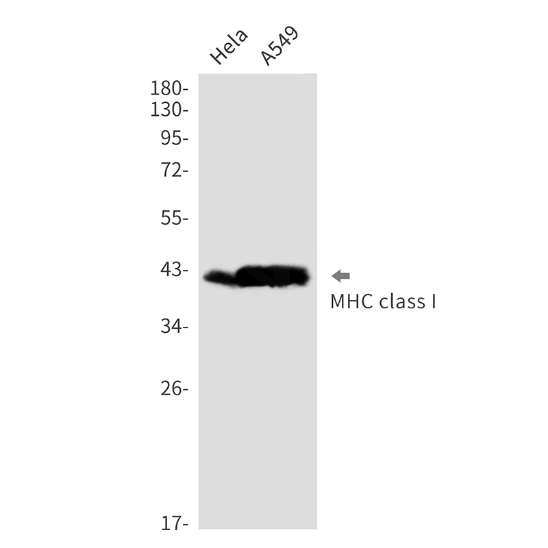 MHC Class I Rabbit mAb