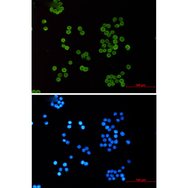 Acetyl-Histone H4 (Lys5) Rabbit mAb