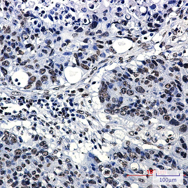 Acetyl-Histone H4 (Lys5) Rabbit mAb