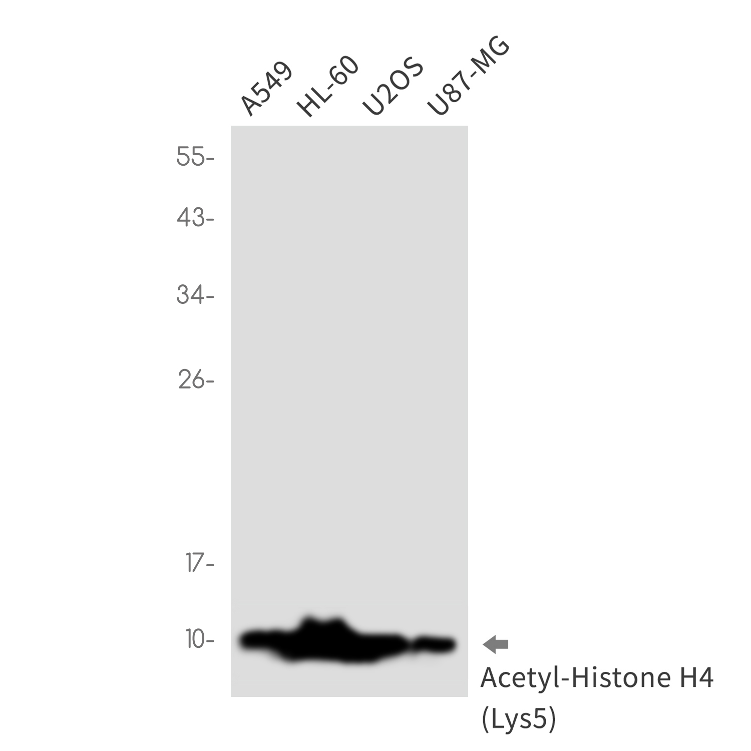 Acetyl-Histone H4 (Lys5) Rabbit mAb