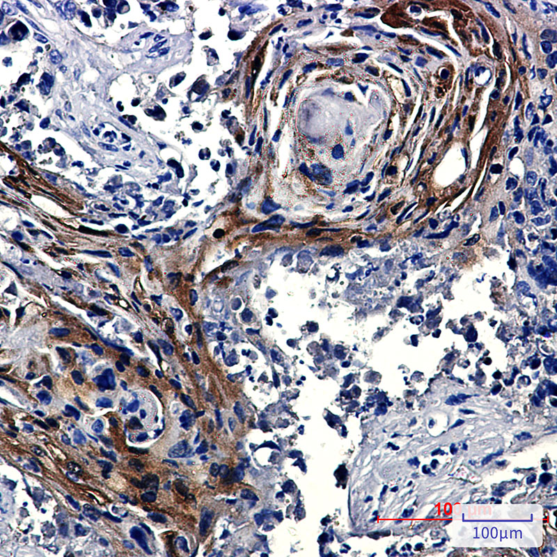 Insulin Degrading Enzyme Rabbit mAb