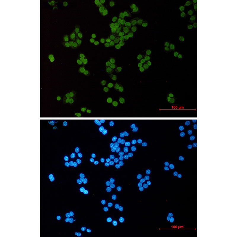 Acetyl-Histone H3 (Lys14) Rabbit mAb