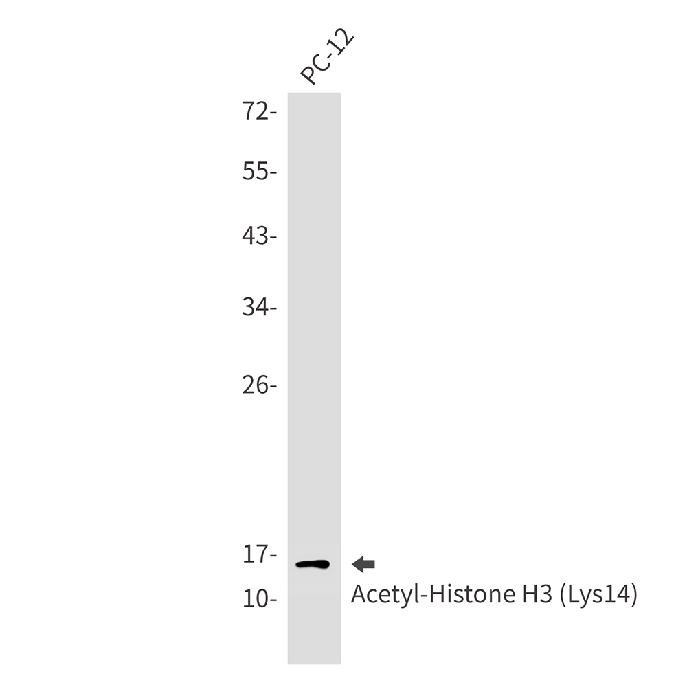 Acetyl-Histone H3 (Lys14) Rabbit mAb