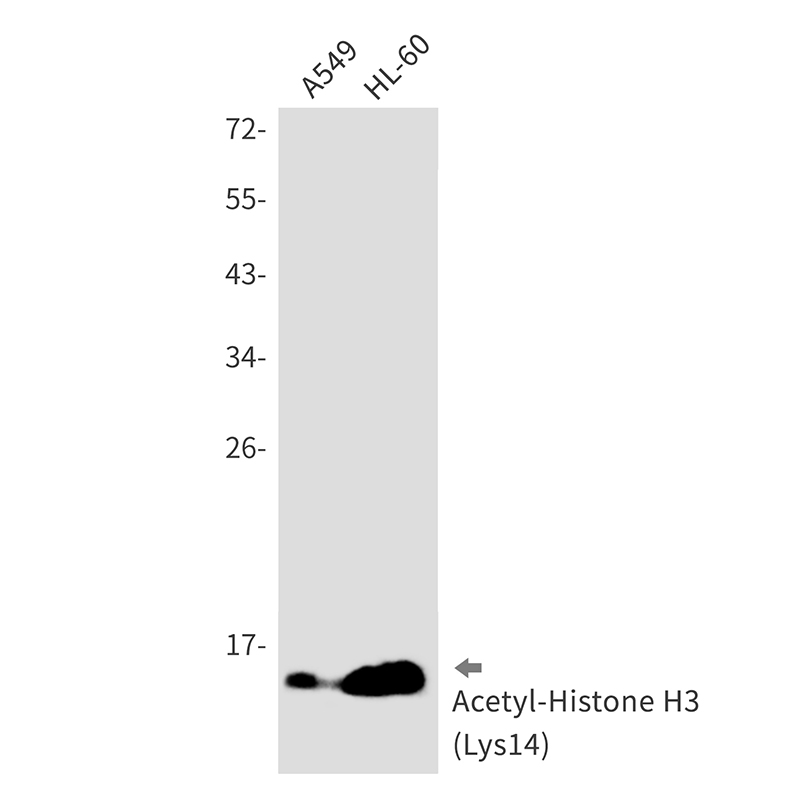 Acetyl-Histone H3 (Lys14) Rabbit mAb