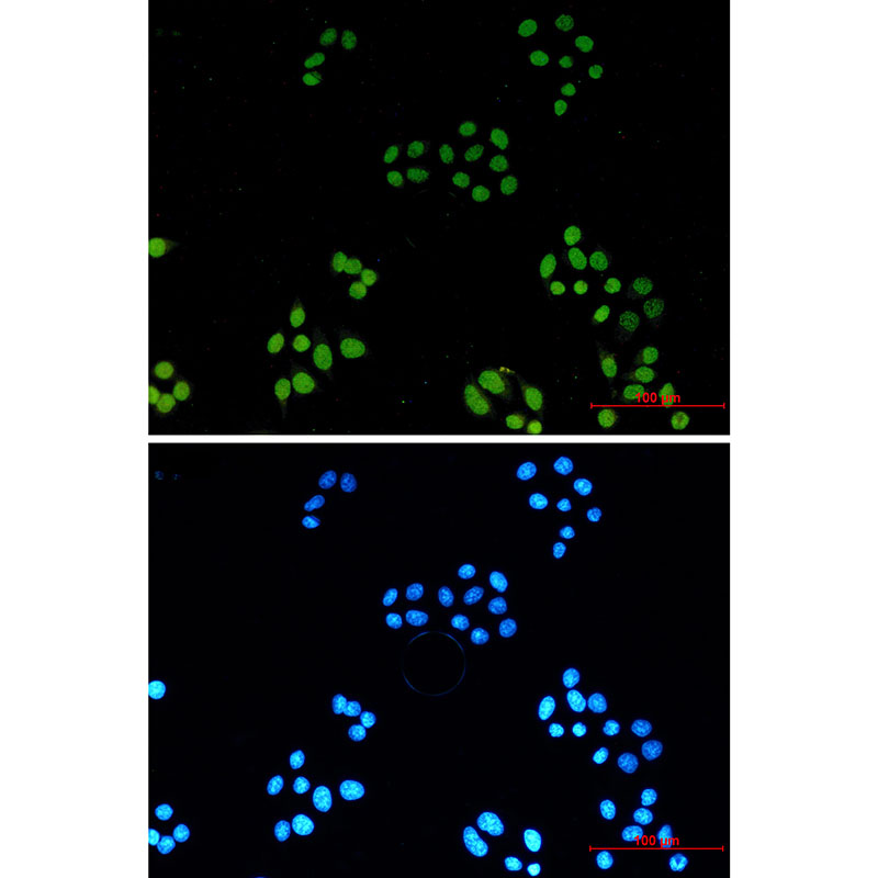 Acetyl-Histone H3 (Lys4) Rabbit mAb