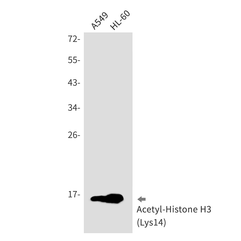 Acetyl-Histone H3 (Lys4) Rabbit mAb