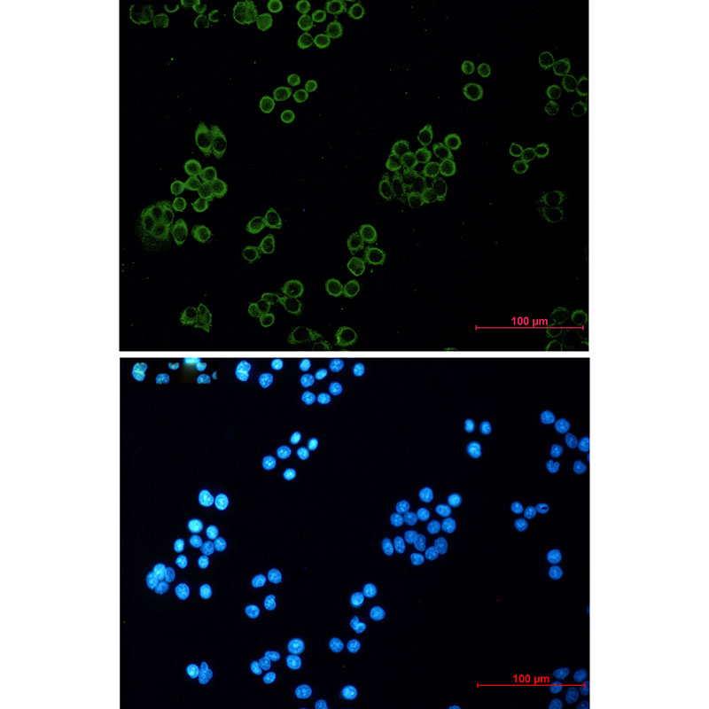 Human kappa Light Chain Rabbit mAb