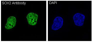 SOX2 Rabbit mAb