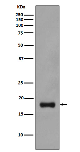 Stathmin 1 Rabbit mAb