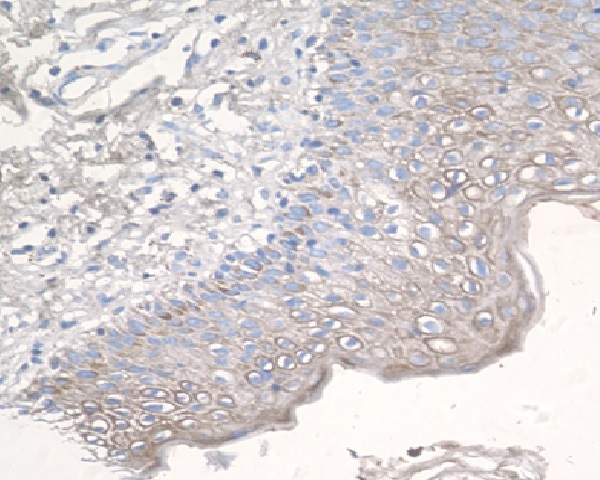 CCR3 Rabbit mAb  