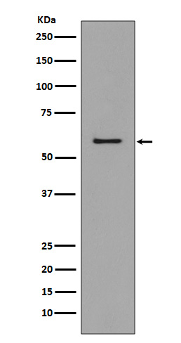 CCR3 Rabbit mAb  