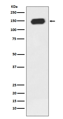 PLCG1 Rabbit mAb