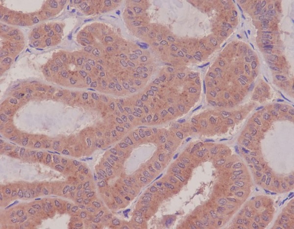 RHOA Rabbit mAb