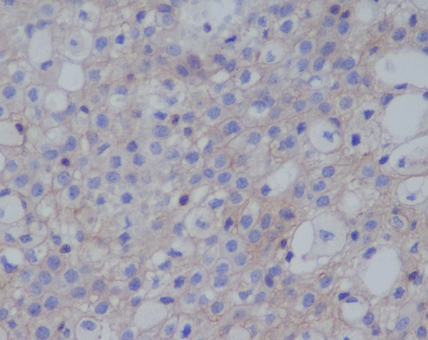 PD-L1 Rabbit mAb