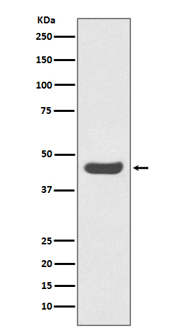 PD-L1 Rabbit mAb