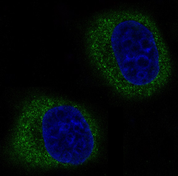 Mitofusin 2 Rabbit mAb