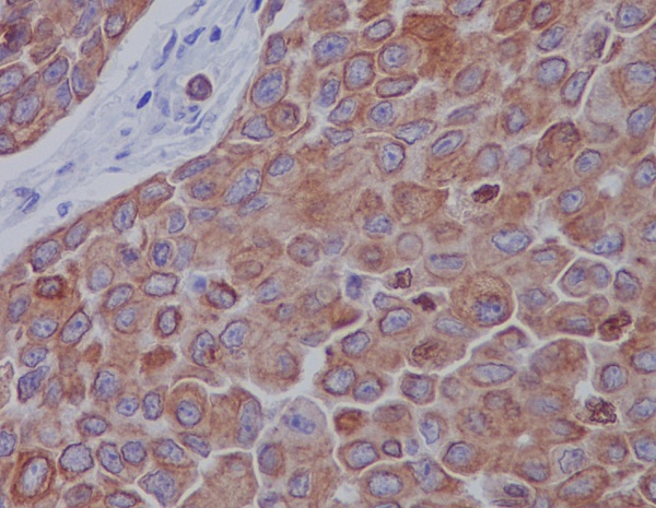 Mitofusin 2 Rabbit mAb