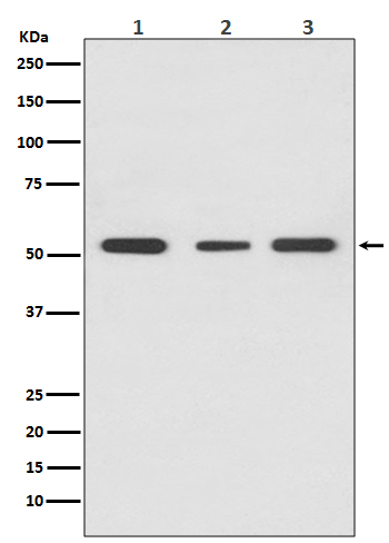 PPAR gamma Rabbit mAb