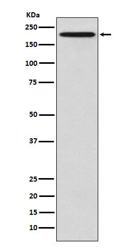 GCN2 Rabbit mAb