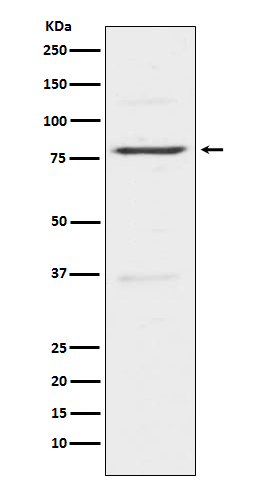 Insulin Receptor Related Protein Rabbit mAb