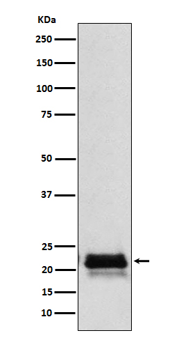 FSH beta  Rabbit mAb