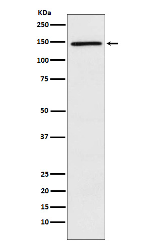 PLCG2 Rabbit mAb