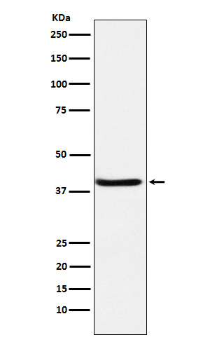 SerpinB3 Rabbit mAb