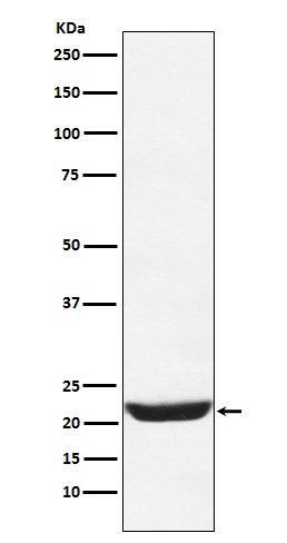 NCS1 Rabbit mAb