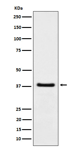 HDGF Rabbit mAb