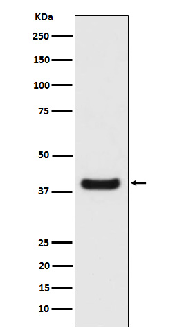 Erlin-2 Rabbit mAb