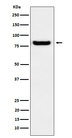 Glucosidase 2 subunit beta Rabbit mAb