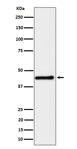 DPF2 Rabbit mAb