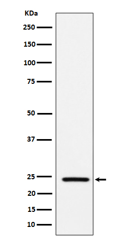 Acetyl-SOD2 (Lys68) Rabbit mAb