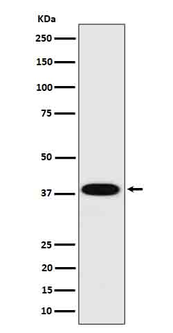 Cathepsin H Rabbit mAb