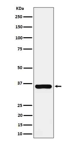 GGH Rabbit mAb