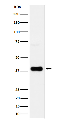 CXCR6 Rabbit mAb