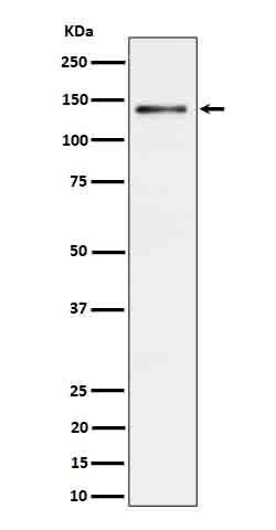 Ceruloplasmin Rabbit mAb