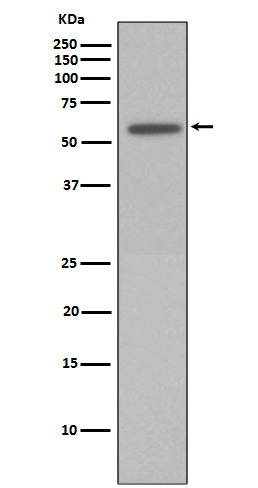 Phospho-Vimentin (Ser72) Rabbit mAb