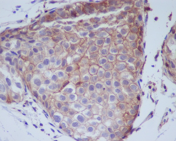 Phospho-EGFR (Tyr1068) Rabbit mAb  