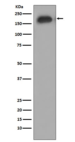 Phospho-EGFR (Tyr1068) Rabbit mAb  