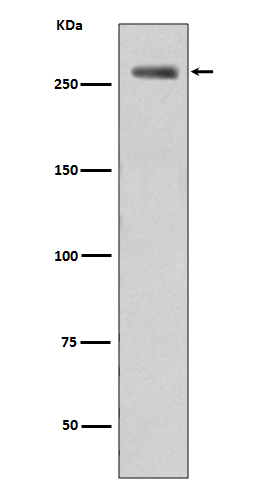 Phospho-LRRK2 (Ser935) Rabbit mAb 