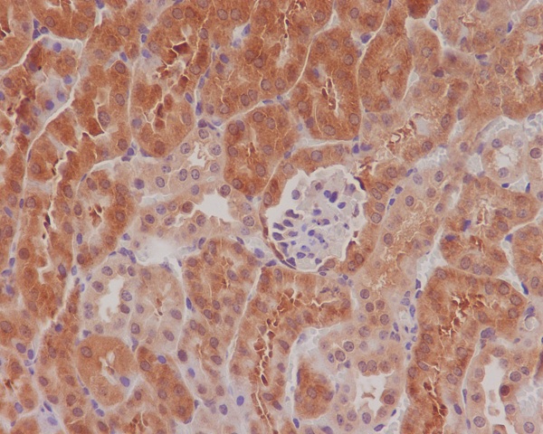 Phospho-eIF4E (Ser209)  Rabbit mAb