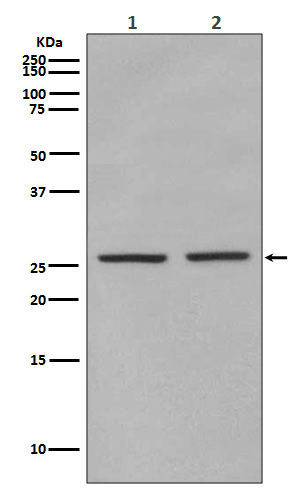 Phospho-eIF4E (Ser209)  Rabbit mAb