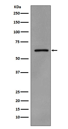 Phospho-Src (Tyr419) Rabbit mAb