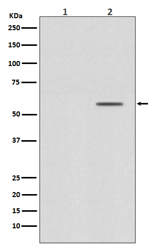 Phospho-Smad2 (Ser250) Rabbit mAb