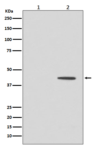 Phospho-MEK1 (Thr292) Rabbit mAb