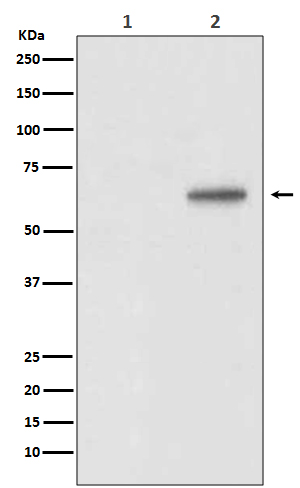 Phospho-AKT1 (Thr450) Rabbit mAb