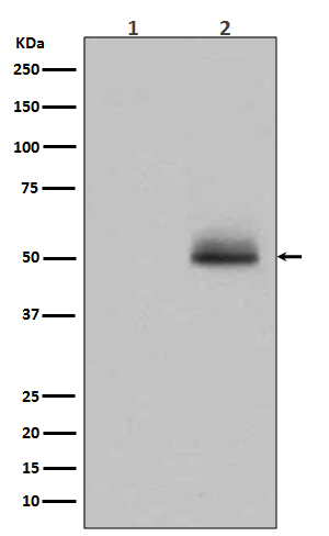 Phospho-GSK3 (alpha + beta)(Tyr216/Tyr279) Rabbit mAb