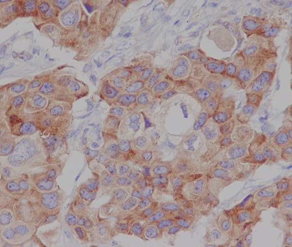 Phospho-mTOR (Ser2448) Rabbit mAb