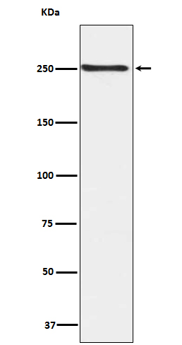 Phospho-mTOR (Ser2448) Rabbit mAb